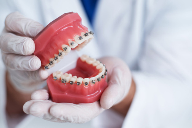 orthodontic treatment