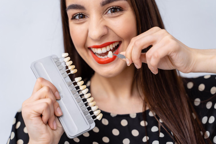 consider dental veneers consider dental veneers