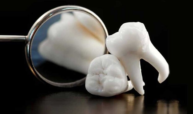 Wisdom Tooth Extraction: All Information You Need to Have
