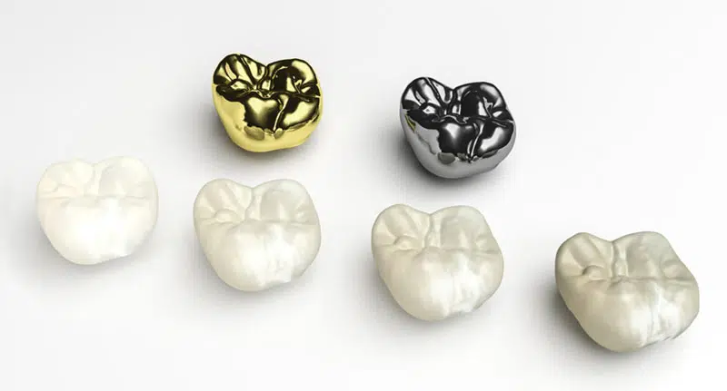 types-of-dental-crowns2