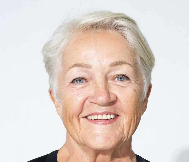 Benefits of Dentures