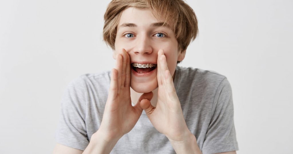 Fix Crooked Teeth Without Braces