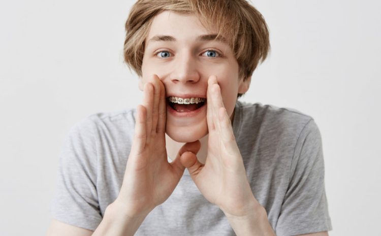  How Cosmetic Dentistry Can Fix Crooked Teeth Without Braces