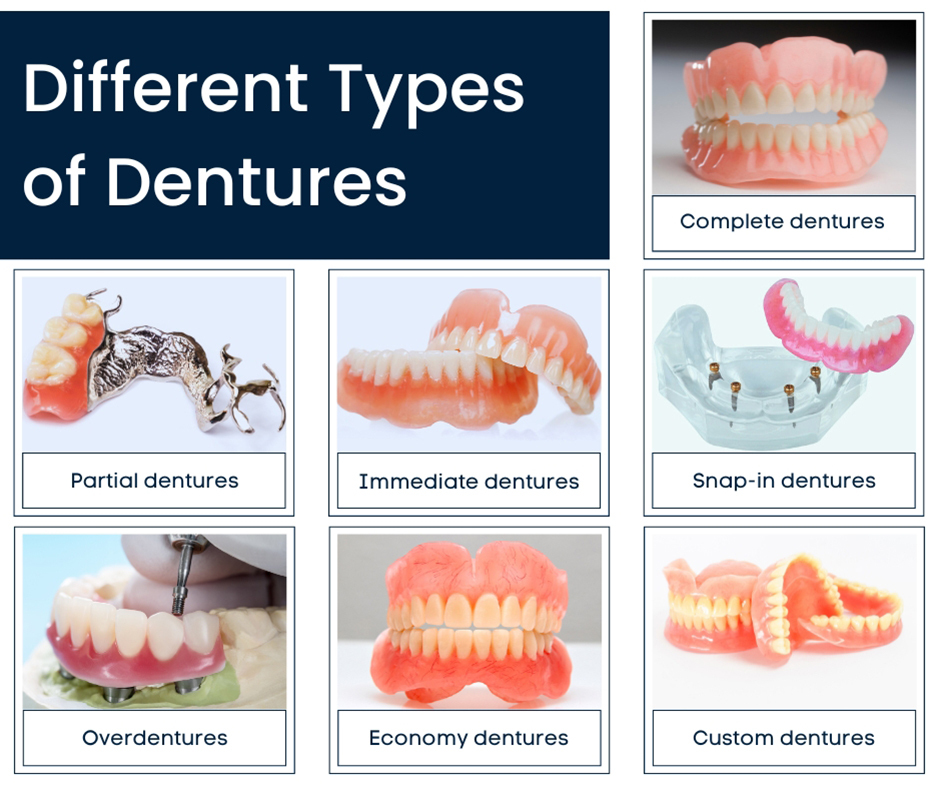 Types of Dentures We Offer at Smile Point Dental