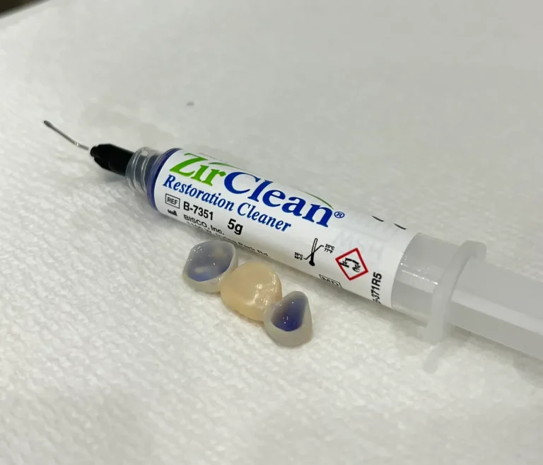 Who Can Benefit from Crowns and Bridges?