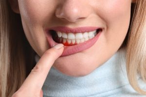 Advanced Periodontics in Oakville