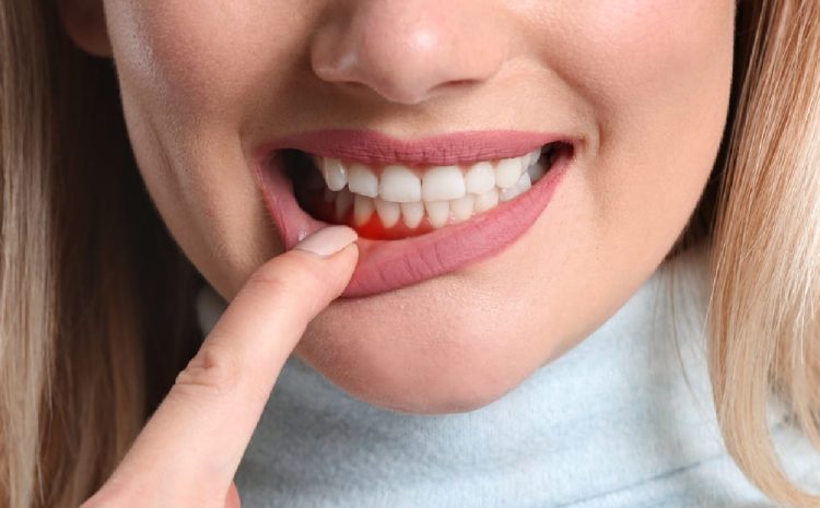 Advanced Periodontics in Oakville