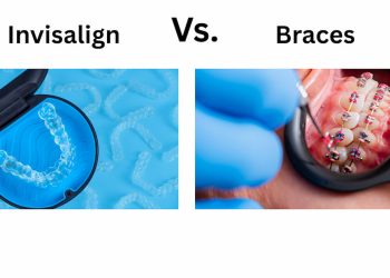 Invisalign vs Braces Which Treatment Fits Your Needs