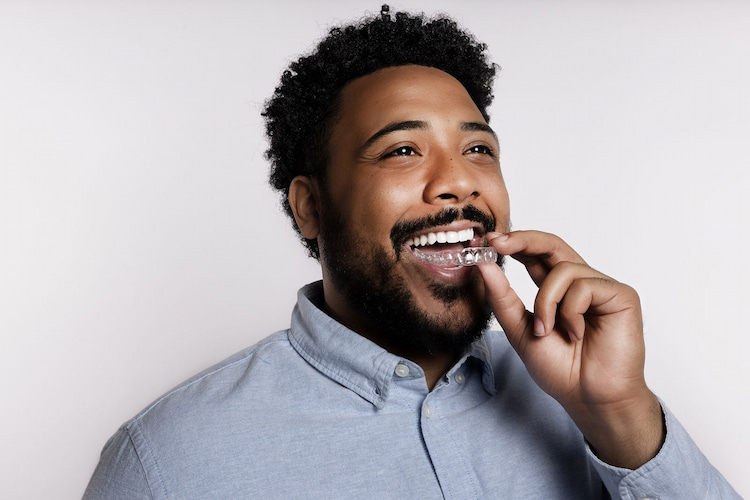 Candid clear aligner