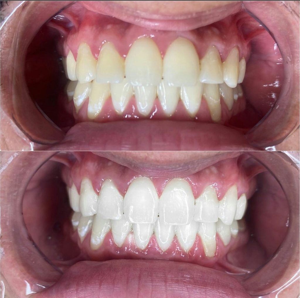 See the Stunning Results