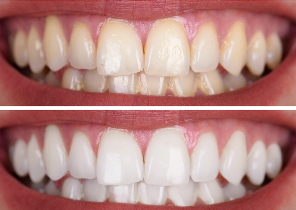 See the Stunning Results