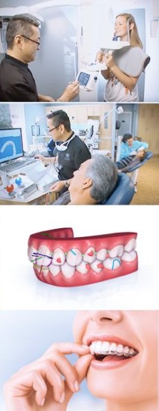 How Invisalign Treatment Works at Smile Point Dental​