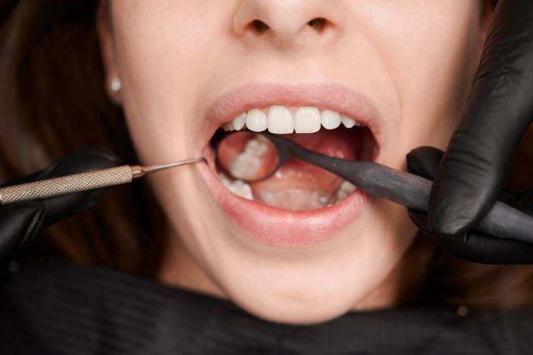 A dentist checks woman's teeth for advising root canal alternatives