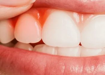 she wants to know the best antibiotic for gum infection