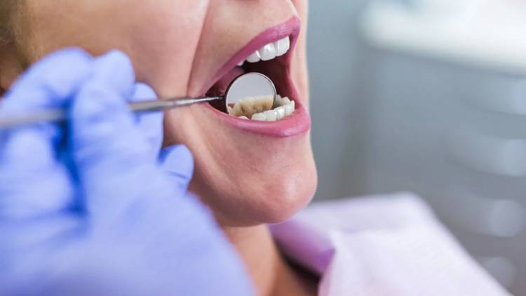 The patient comes to visit dentist because the symptoms of dental infection