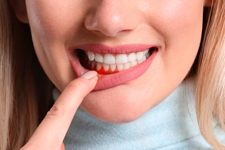 she does not know the best antibiotic for gum infection