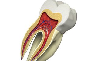 smile point walk in dental clinic11